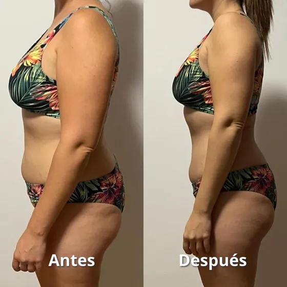 Cambio físico de una clienta del Método Modrego, de perfil