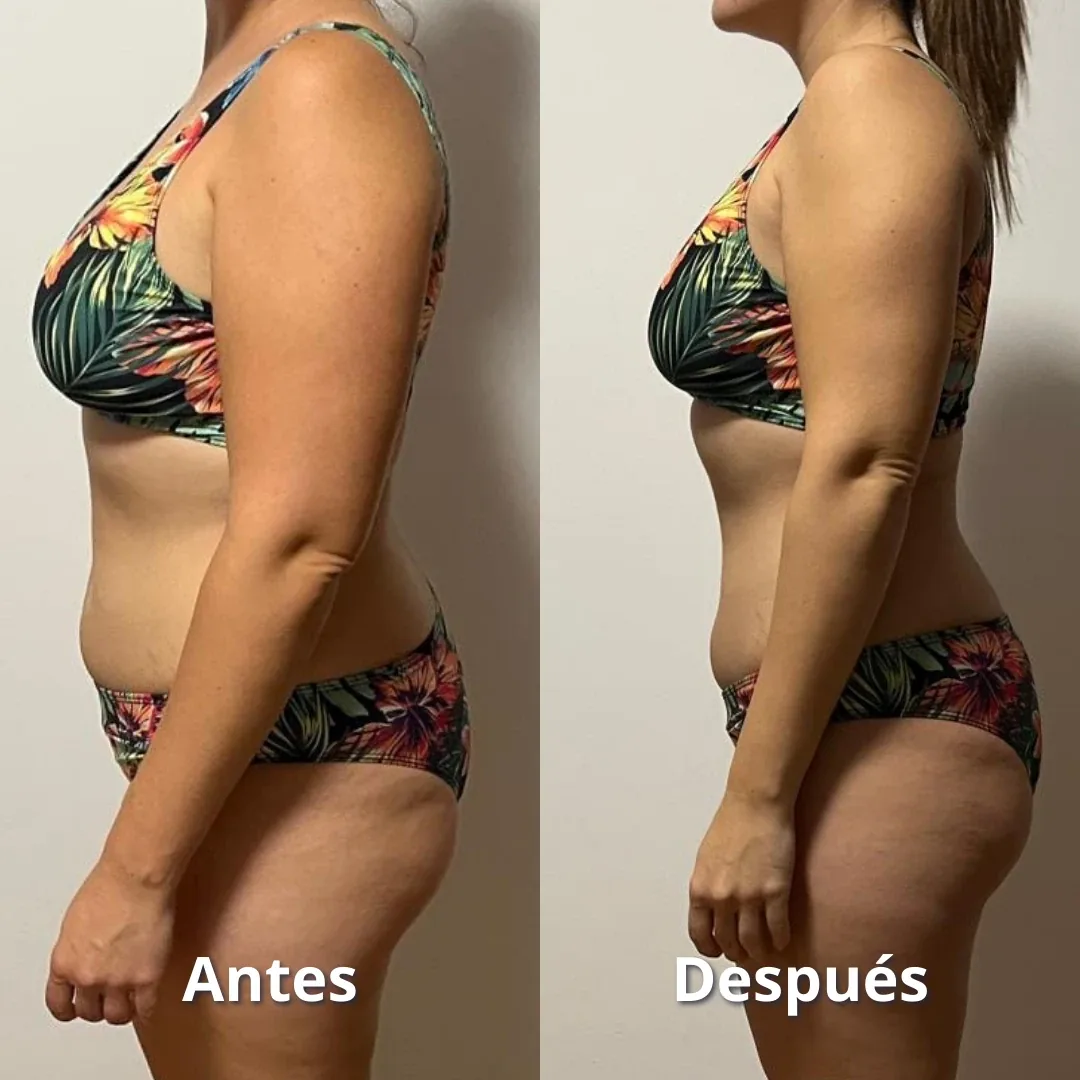 Cambio físico de una clienta del Método Modrego